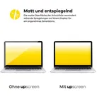 upscreen Reflection Shield Matte Premium Displayschutzfolie für Philips Brilliance