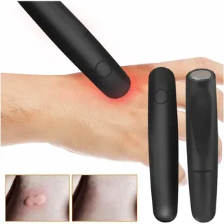XZincer Insektenstichheilers, Elektronischer Anti-juckreiz-stift, Mückenstich Elektro Stichheiler, zur Behandlung von Juckreiz, Brennen, Schmerz Und Schwellung Insektenstichen Lindert (A, One Size)