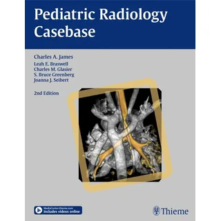 Pediatric Radiology Casebase von Charles A. James/ Leah E. Braswell/ Charles M. Glasier/ Bruce S. Greenberg/ Joanna J. Seibert / Thieme Publishers New